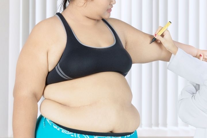 Mujer con obesidad siendo medida